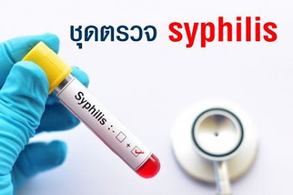 ชุดตรวจ syphilis ตรวจโรคติดเชื้อแบคทีเรีย