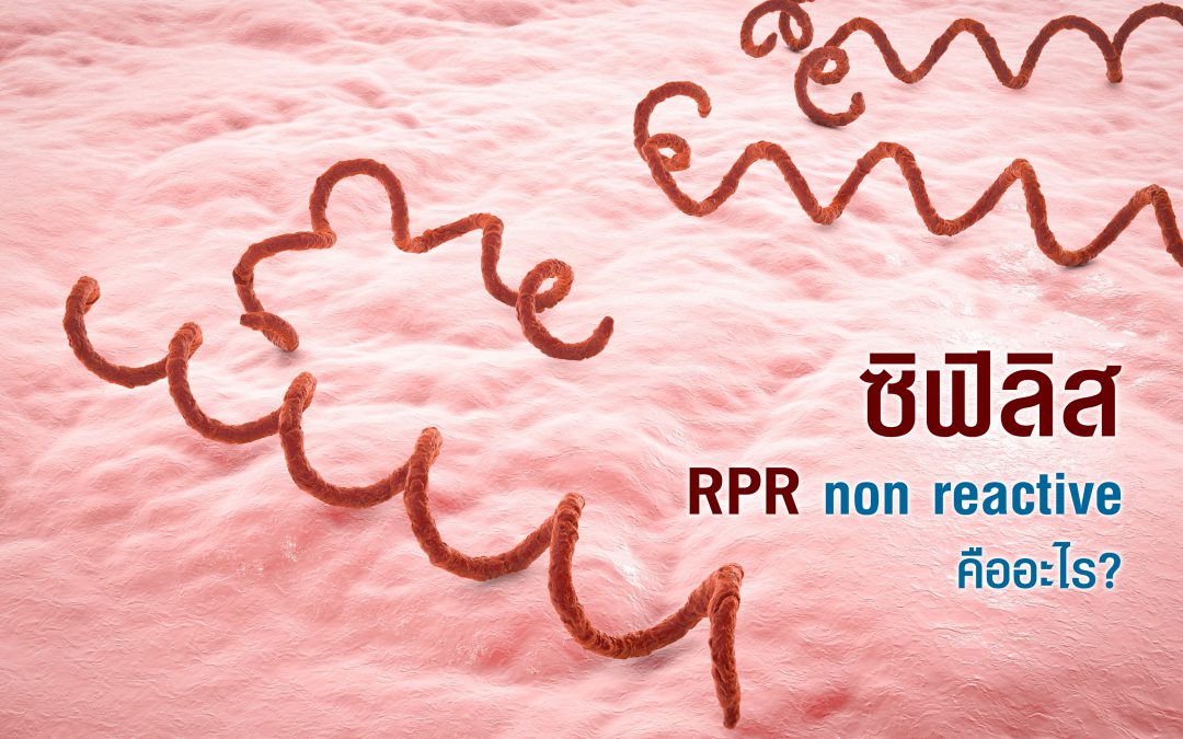 RPR non reactive คือ อะไร? โรคซิฟิลิสกับการตรวจหาเชื้อ